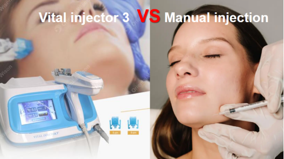 The Advantages of the Vital Injector Compared to Manual Injection
