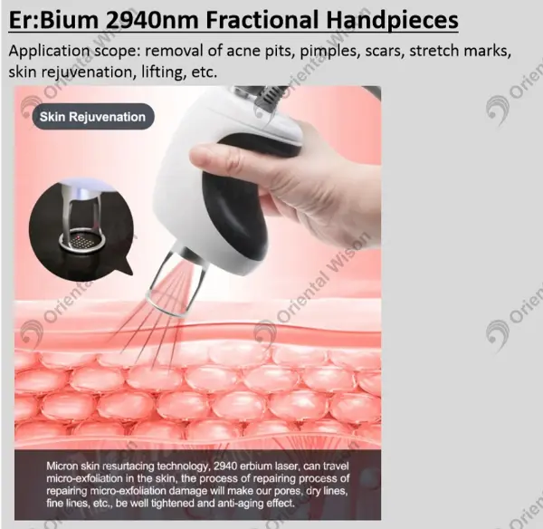 New Skin Renew Expert- 2940nm Erbium Laser