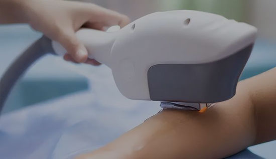 IPL Laser Machine