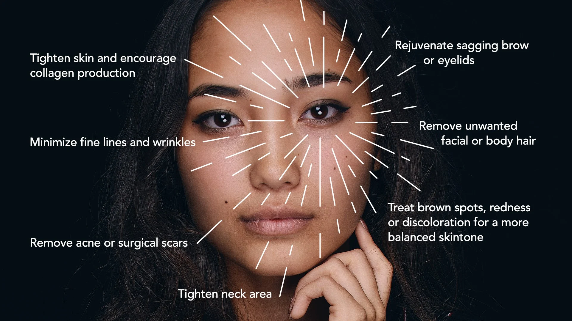 2026 Aesthetic Laser Market: Beijing Oriental Wison Delivers a Full-Spectrum Portfolio